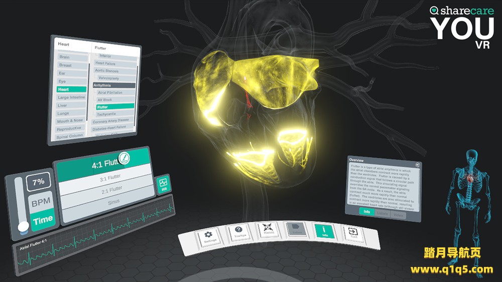 3D人体模拟（Sharecare YOU VR）