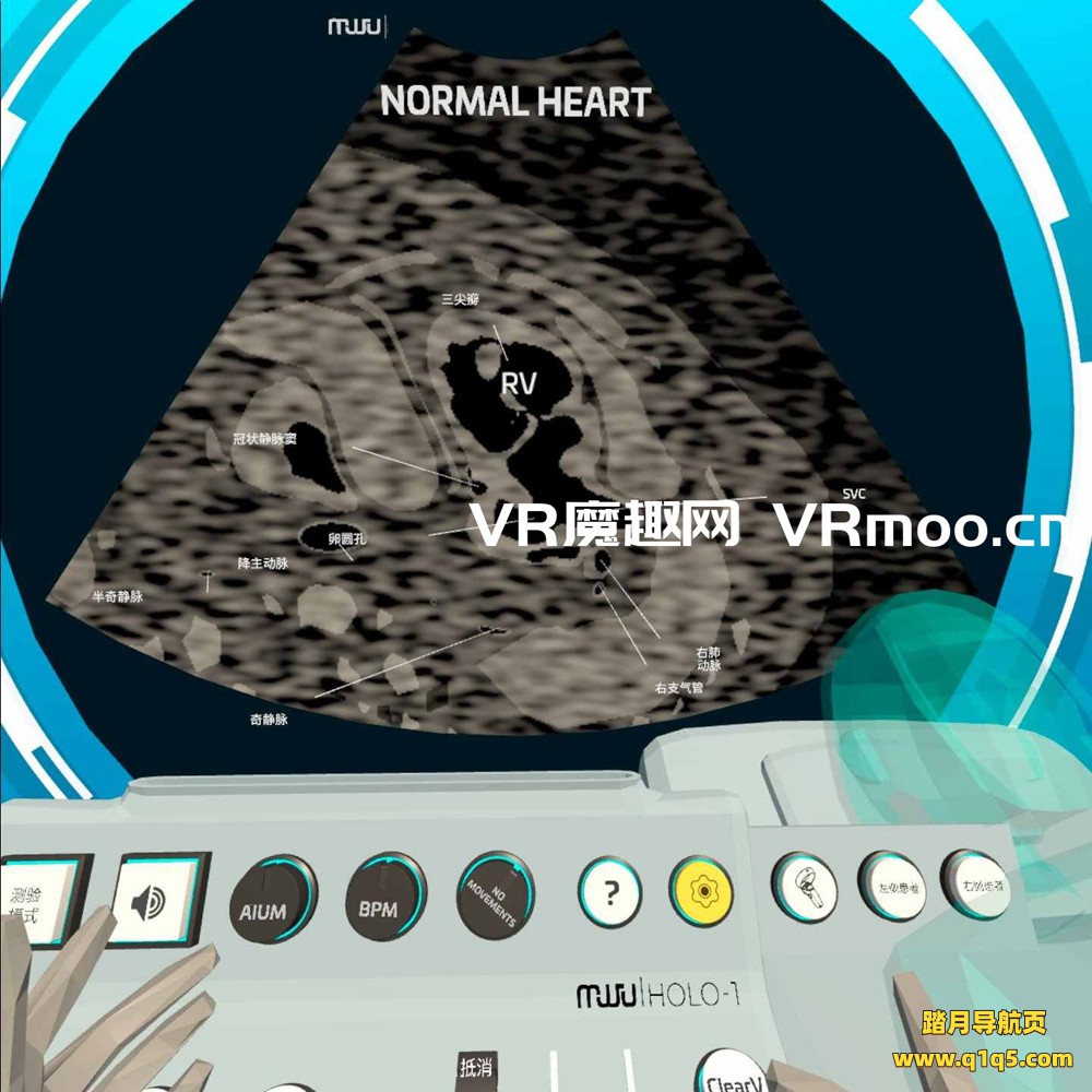 Oculus Quest 医学《心脏病医学VR汉化版》Fetal Heart VR