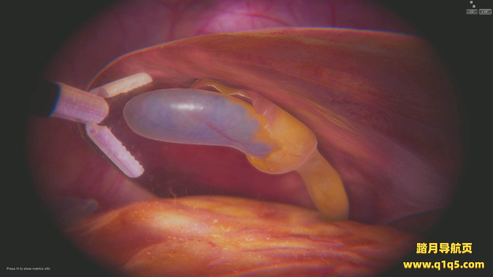 Oculus Quest 游戏《手术VR》SurgicaVR