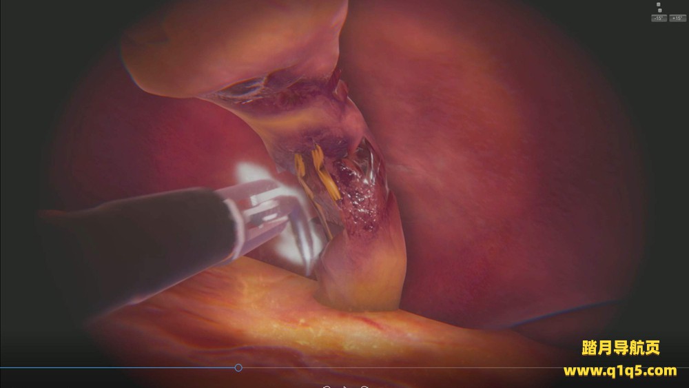 Oculus Quest 游戏《手术VR》SurgicaVR