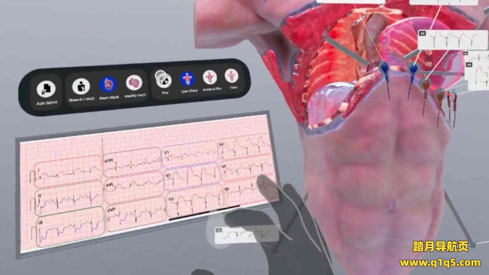 Meta Quest 游戏《了解心脏病》Understanding Heart Attack