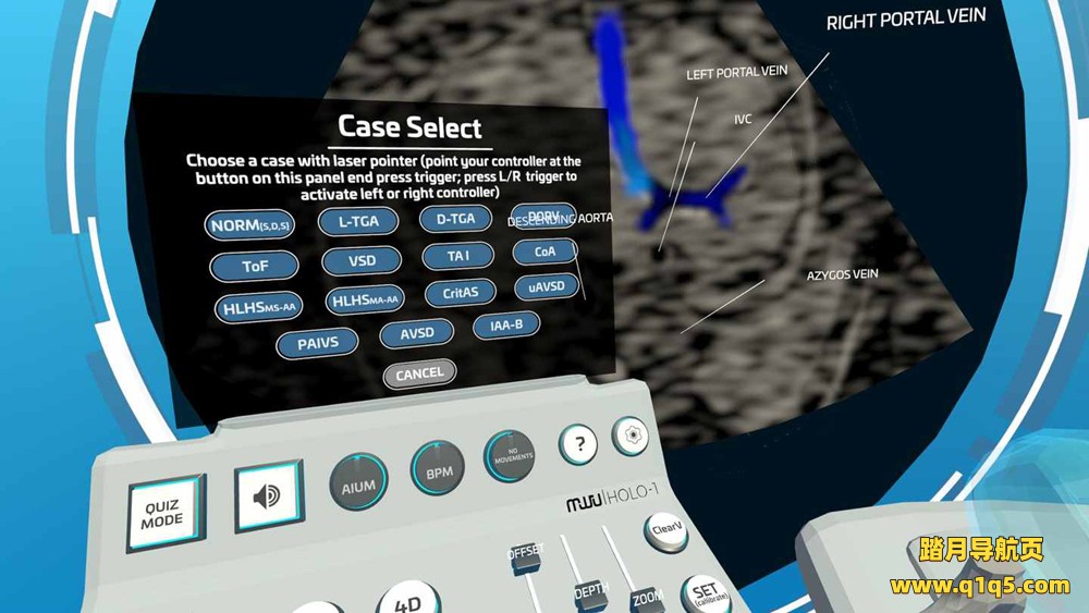 Oculus Quest 游戏《心脏病医学VR》Fetal Heart VR