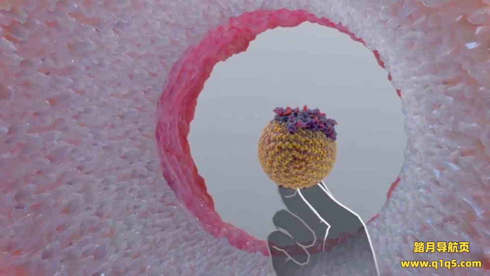 Meta Quest 游戏《了解心脏病》Understanding Heart Attack